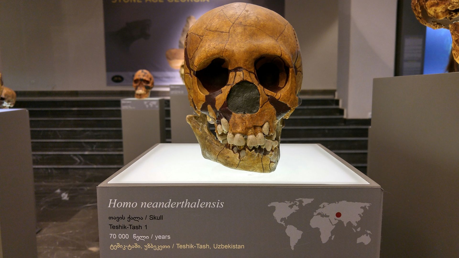 A Neanderthal got an ancient root canal